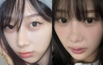 ジゼルは整形で顔変わった？美貌変化を徹底検証 