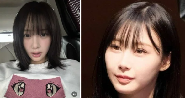 ジゼルは整形で顔変わった？美貌変化を徹底検証 
