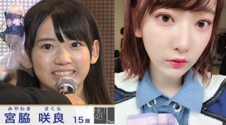 ルセラフィム さくら整形疑惑の真相！HYBE鼻への変化とファンの反応を徹底検証